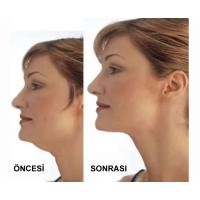 Gıdı Toparlama Boyun Gıdı Masaj Aleti